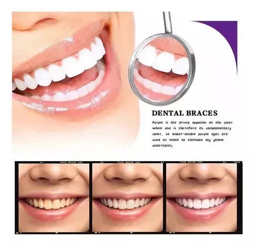 Crema Blanqueadora Dental Smilekit