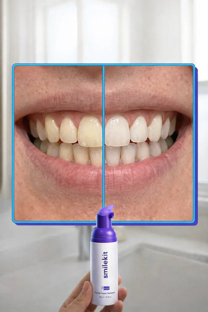 Crema Blanqueadora Dental Smilekit