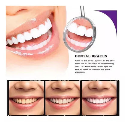 Crema Blanqueadora Dental Smilekit